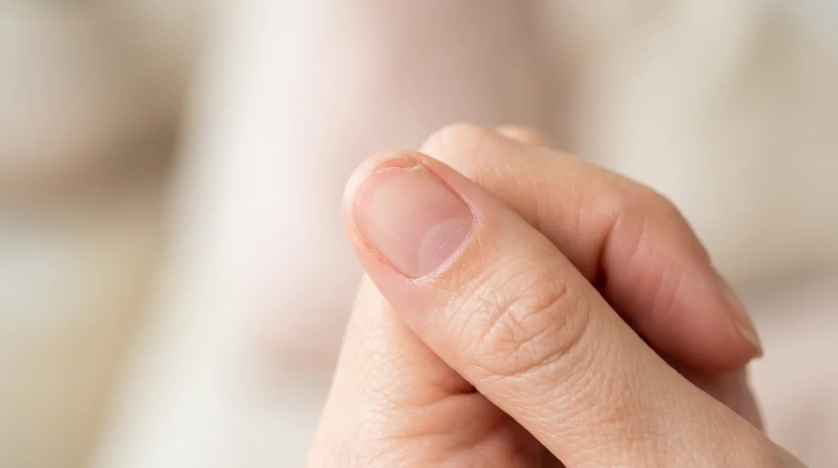 Que faire quand les ongles se décollent